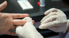 HIV, smartphone-based test, HIV detection, HIV outbreaks, surface acoustic wave biochips, microelectric components, quartz biochips, HIV antibodies, public health intervention, antiretroviral treatment, recombinant surgery