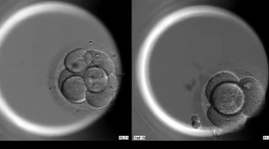 Genome editing used to alter DNA function in human embryos | Technology News,The Indian Express Genome editing used to alter DNA function in human embryos | Technology News,The Indian Express