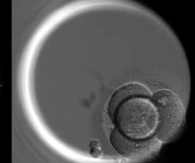 Genome editing, human embryos, DNA functioning study, Francis Crick Institute, CRISPR techbnique, genome protein production, OCT4 protein, egg development, blastocyst, human embryo research, in-vitro fertilisation treatment, Human Fertilisation and Embryology Authority