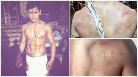 Photos: Siddharth Nigam hurt on Chandra Nandini sets, but he is all happy about it. Read why