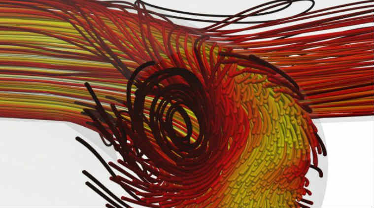 Artificial intelligence, blood flow, dialysis, Imperial College London, machine learning algorithms, AI dialysis, arterio-venous fistula, aerospace modelling, AVF surgery, better dialysis