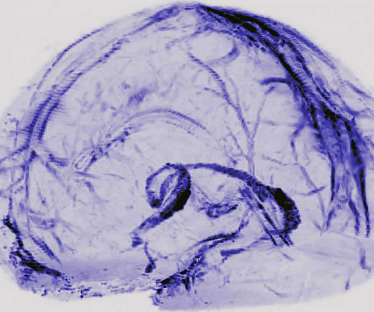 Brain, lymphatic system, US National Institutes of Health study, National Institutes of Neurological Disorders and Strokes, blood vessels, lymphatic vessels, brain immune-system relation, brain scans, autopsy studies