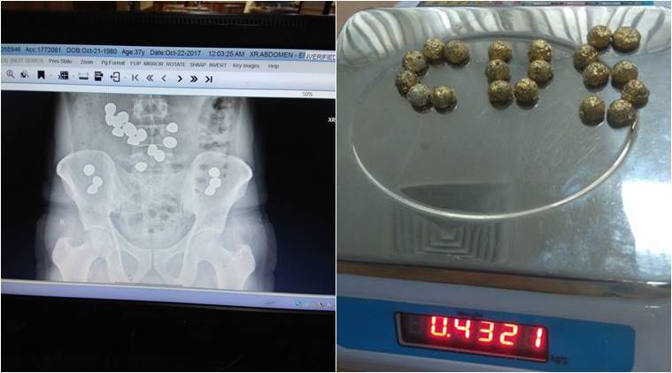Gold Bits seized Tamil Nadu, Tamil Nadu Gold bits seizure, Coimbatore airport, Coimbatore airport gold seized, Sri Lankan airways passenger gold bits seized, gold bits in abdomen, India news, Tamil Nadu news, Indian Express news