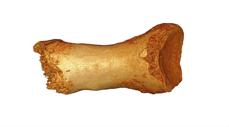 Neanderthal DNA, Max Planck Institute for Evolutionary Anthropology, human traits, skin and hair biology, Neanderthal alleles, circadian rhythms, genetic data