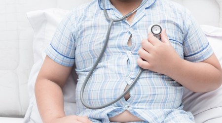 world obesity day 2017, world obesity day, things to do to avoid obesity, ways of staying healthy, maintain healthy weight, ways to maintain healthy weight, Indian express, Indian express news