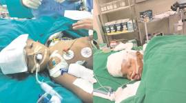 AIIMS, AIIMS surgery, twins surgery, AIIMS twins surgery, AIIMS conjoined twins surgery, twins separated, surgery twins separated, Kalia, Jagga,