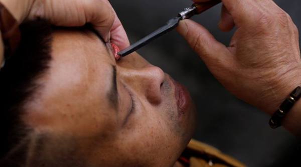 eyelid shave, eye shave, eyelid shave with blade, china eyelid shave, eye cleaning with blade, eye wash, odd news, bizarre news, indian express,