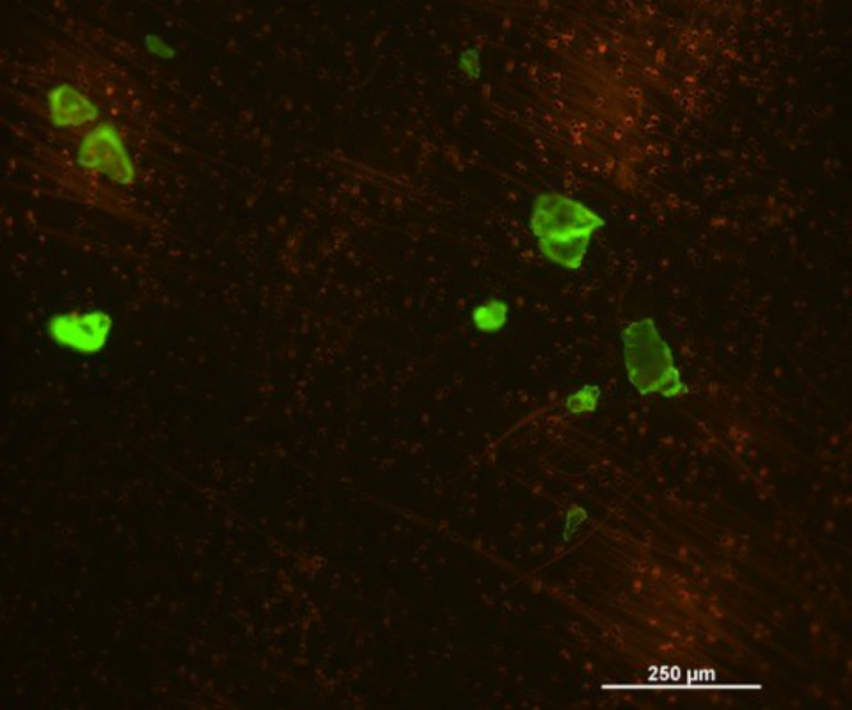 Microplastics, fluorescent dyes, University of Warwick, human hair, wool fibres, surface sea water, beach sand, plastic waste, polypropelyne, weathering, marine debris