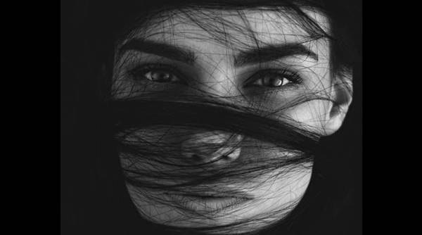 woman hairball removed surgery, doctors remove hair from stomach, rapunzel syndrome, MP woman hair ball stomach surgery, 1.5kg hairball, indian express, indian express news