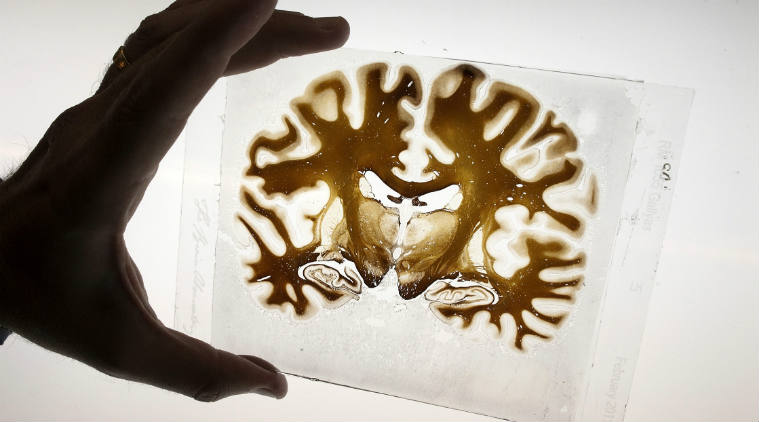 A new research study aims to map the brain in 3-D, so as to help track the source of neurological disorders, and to differentiate functions of its various parts.