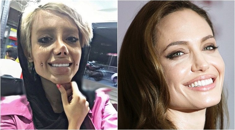 Iranian Teen Goes Through 50 Plastic Surgeries To Look Like Angelina Jolie Photos Go Viral