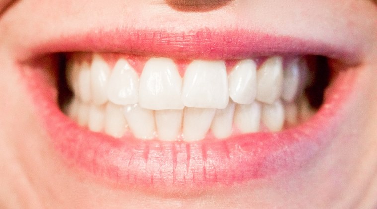 teeth, healthy teeth, how to maintain healthy teeth, dentist advice on healthy teeth, indian express, indian express news