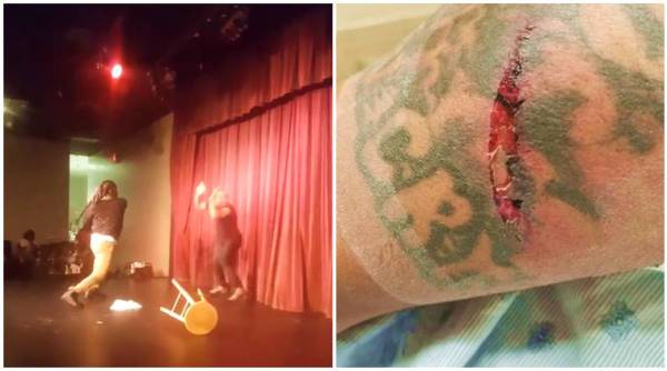 steve brown attacked, comedian steve brown, comedian attack, comedian steve brown attacked with mic, indian express, indian express news