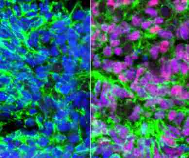 Stem cell research, nerve cells from stem cells, UCLA, sensory interneurons, spinal cord, paralysis cure, bone proteins, skin cells, signalling molecules