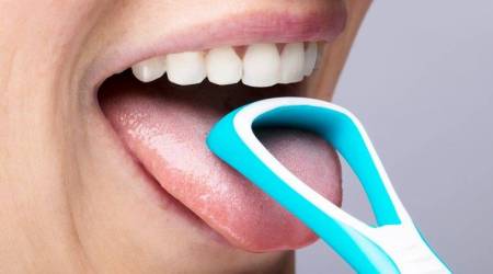 white tongue, coated tongue, furry tongue, hairy tongue, how to clean tongue, oral hygiene, oral health, oral health tips, how to take care of oral hygiene, white tongue removal, coated tongue remove, indian express, indian express news