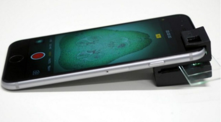 'clip-on' turns smartphone into microscope | Technology News,The Indian Express