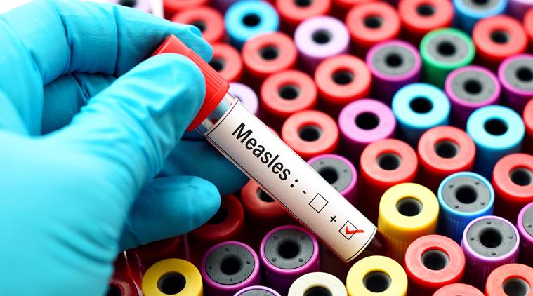 gujarat measles outbreak, kutch measles outbreak, measles outbreak gujarat, indian express, gujarat health department