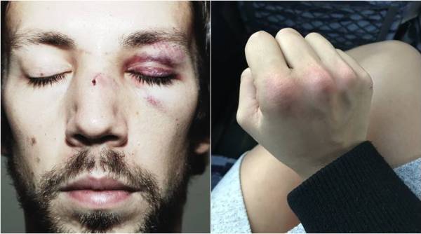 woman punch man face Dublin, Leanna Carr, Leanna Carr twitter, woman dublin punch, American tourist in Dublin assaulted, Leanna Carr assualted in Dublin, powerlifter leanna carr, indian express, indian express trending news