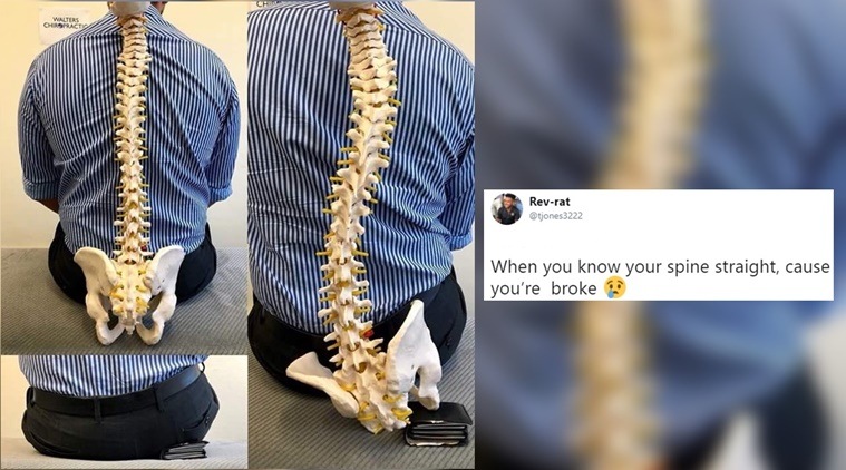 Straight your Spine. Sterling Spine memes. Rope that hangs your head Straightning Spine.