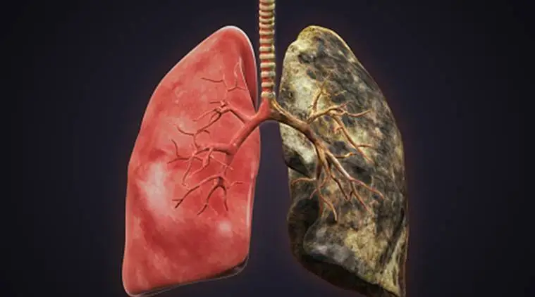 smoker lung sounds