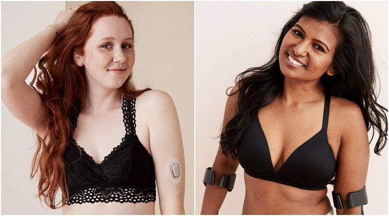American lingerie brand Aerie takes inclusivity to new level; features  models with medical conditions