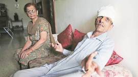 panchkula, feeding stray dogs, ex air force officer attacked, sector 7, panchkula stray dog assault, punjab news, indian express