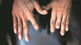 Workplace Injuries: Rage Against The Machine