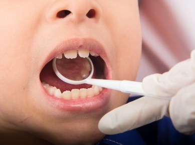 kids teeth, dental issues, kids dentist