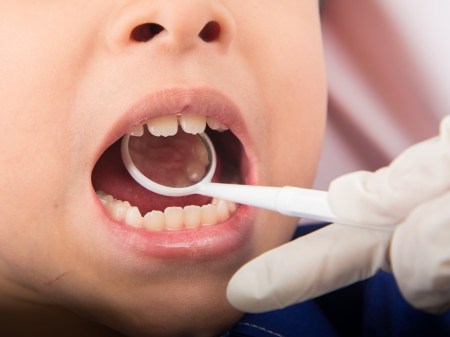 kids teeth, dental issues, kids dentist