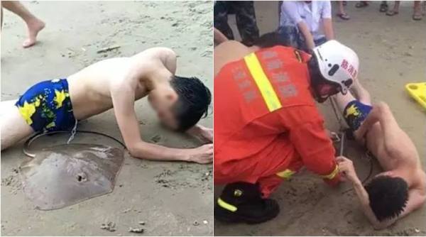 stingray attack, stingray stung penis, stingray stung man genitals, bizarre news, odd news, china news, viral news, indian express