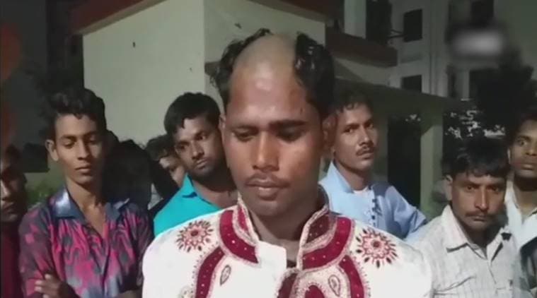 Lucknow Groom Tonsured, Lucknow Groom head Tonsured, Lucknow Groom Tonsured for dowry, dowry demands, lucknow UP dowry rate