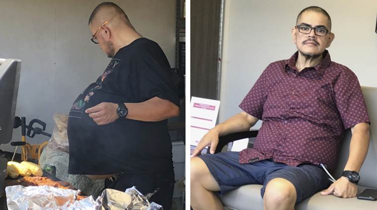 At left, Hector Hernandez in July, a few days before the operation that removed a 77-pound tumor from his abdomen, and at right, a couple of weeks after the surgery. 
