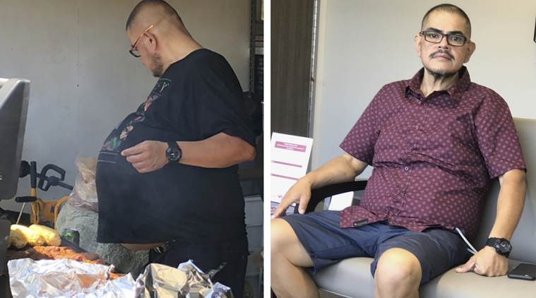 It looked like a beer belly. It turned out that he had a 77-pound tumor.