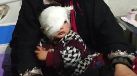 Hiba 20 month girl with pellet injury, pellet injury in girls eye, jammu and kashmir violence, baby injured, girl with pellet injury, j&k violence, indian express