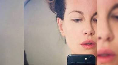 foreskin facial, foreskin from circumsized baby boys south korea, foreskin facial abnormal, kate beckinsale, cate blanchett, katy perry, emma stone, weird facials hollywood, georgia louise, indian express, indian express news