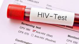 HIV, AIDS, immune system, genomes of animals, animal genome, researchers eliminate HIV, new study, indianexpress.com, indianexpress, indianexpressonline, indianexpressnews, latest study, AIDS, HIV elimination, mice study, latest research, HIV prevention, HIV curable, HIV positive, HIV, what is HIV, no cure for HIV, health news, latest study on HIV, can HIV be eliminated, HIV treatment, HIV treatment for cure, Lewis Katz School of Medicine, AIDS, Nature Communications, human HIV infection, gene editing, HIV infection