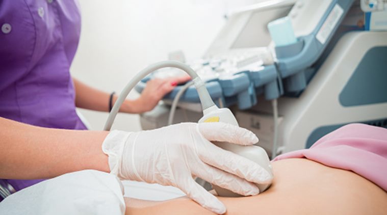 pregnancy ultrasound