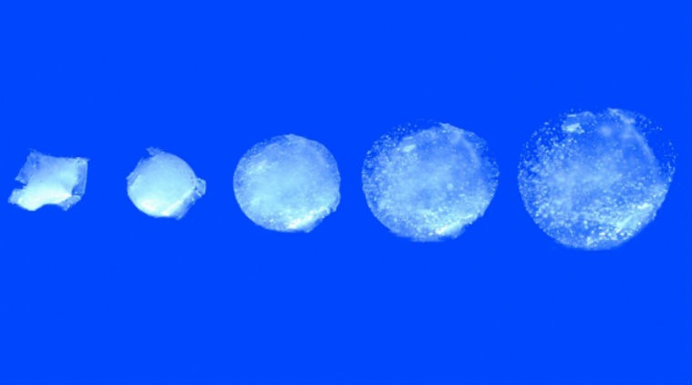 cancer detecting pill, ingestible pill detects cancer, MIT, Massachusetts Institute of Technology, smart pill, stomach cancer, ulcers, inflatable pill to detect cancer, hydrogel pill