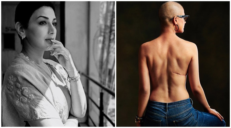 Sonali Bendre, Tahira Kashyap share stories on World Cancer Day
