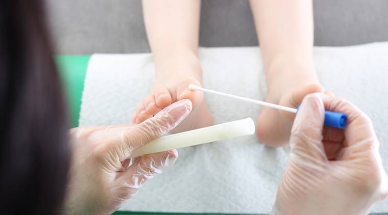 cervical cancer, pap smear test