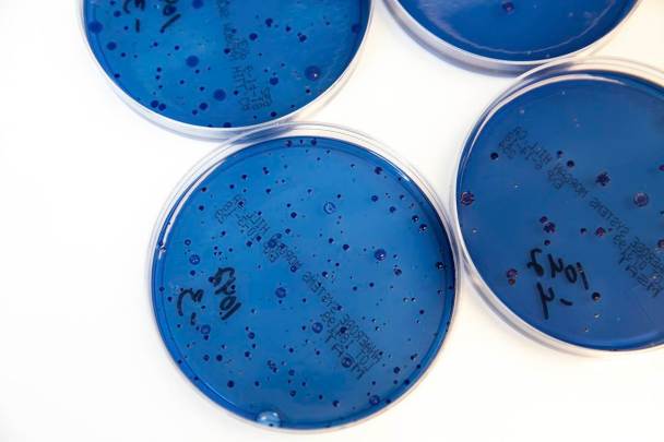 Petri dishes with fecal bacterial colonies 