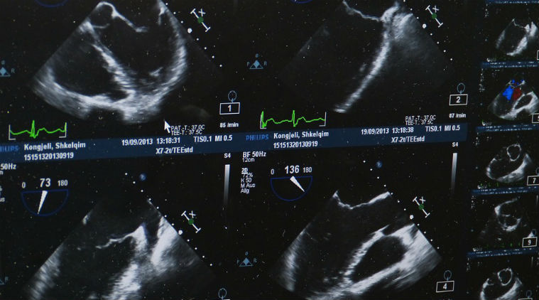 ultrasound, ultrasound machines, ultrasound hacking, ultrasound machine hacking, hacking ultrasound machines, ultrasound machines hacker tampering, ultrasound machien tampering