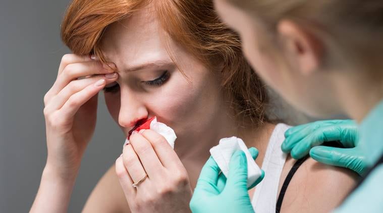 nosebleed-causes-and-treatments-familydoctor