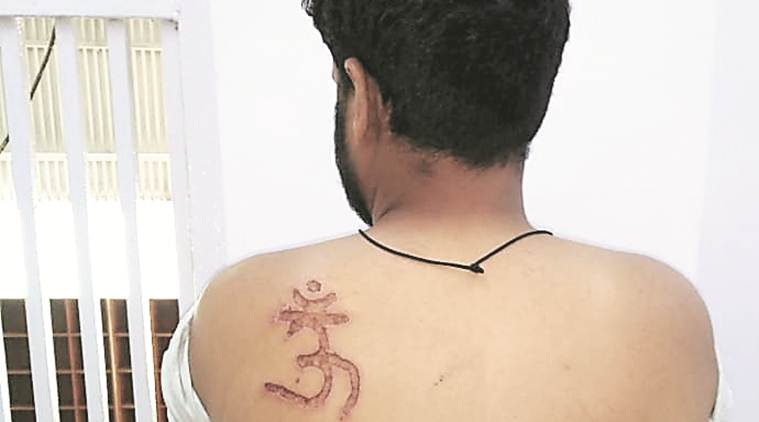 Muslim man om mark, Om tatoo on muslim man, om symbol burnt on muslim man, om symbol on muslim man