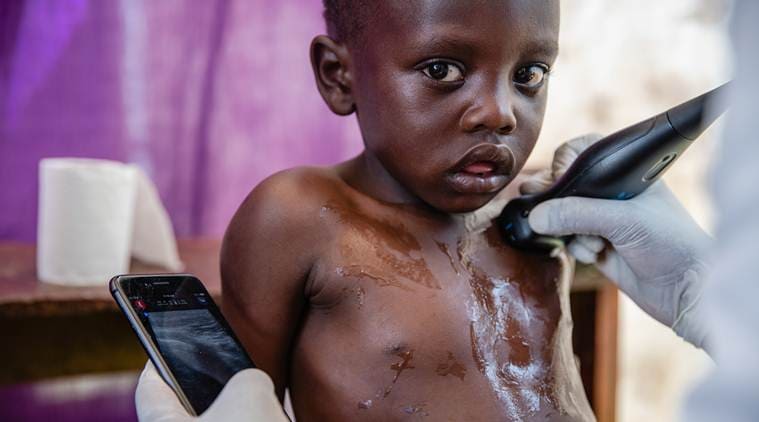 In African villages, these phones become ultrasound scanners