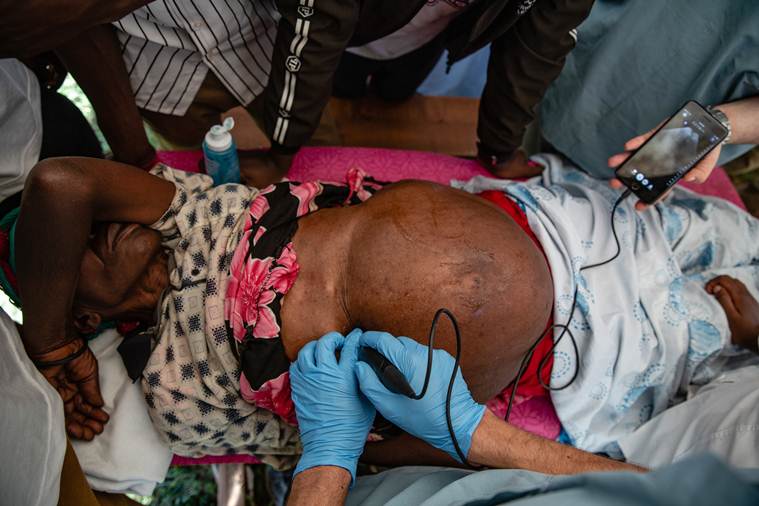 In African villages, these phones become ultrasound scanners