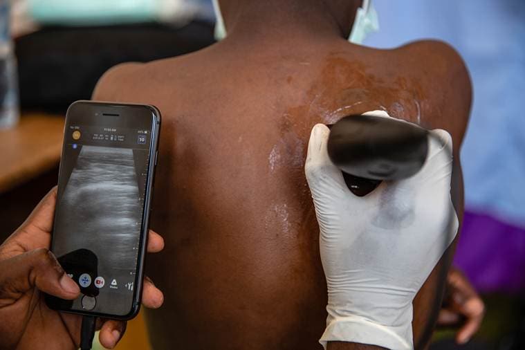 In African villages, these phones become ultrasound scanners