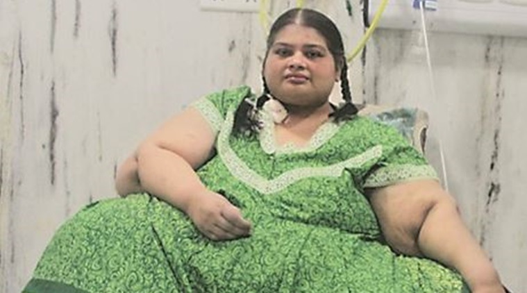 From 300 kg to 86 kg: Pune woman undergoes 2 weight loss surgeries