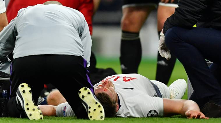 Tottenham's Jan Vertonghen receives medical attention after sustaining an injury