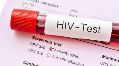 HIV, AIDS, immune system, genomes of animals, animal genome, researchers eliminate HIV, new study, indianexpress.com, indianexpress, indianexpressonline, indianexpressnews, latest study, AIDS, HIV elimination, mice study, latest research, HIV prevention, HIV curable, HIV positive, HIV, what is HIV, no cure for HIV, health news, latest study on HIV, can HIV be eliminated, HIV treatment, HIV treatment for cure, Lewis Katz School of Medicine, AIDS, Nature Communications, human HIV infection, gene editing, HIV infection